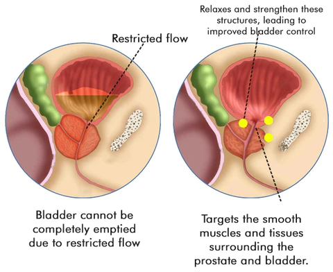 REVIVI™ Напредни капки за терапија на простата
