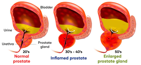 Raindew™ Advanced Prostate Therapy Drops