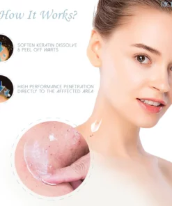 Penghilang Kutil Herba RICPIND SkinSpot
