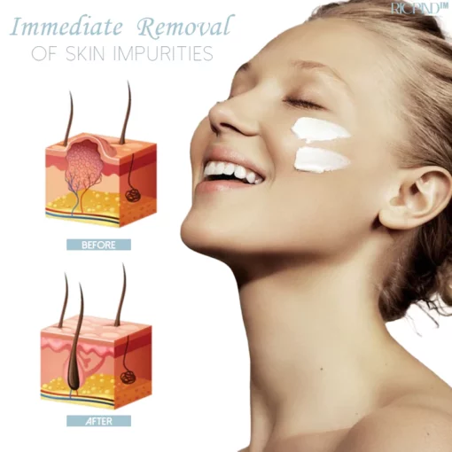 Penghilang Kutil Herba RICPIND SkinSpot