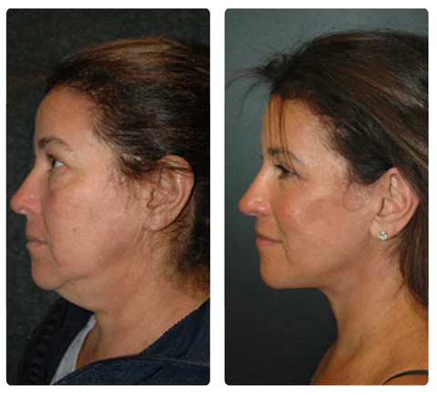 RICPIND Vitality Shine Circulation Spark Ear Clips