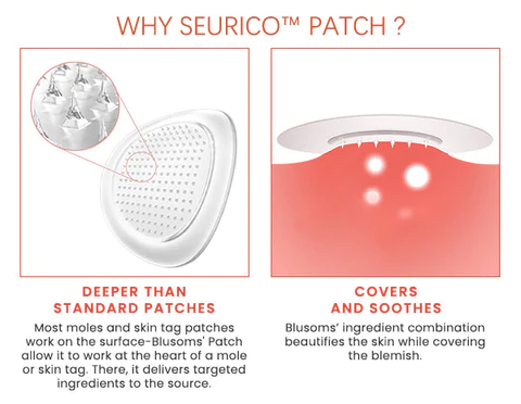 Seurico™ MicroDarts TAG'Gone Patch