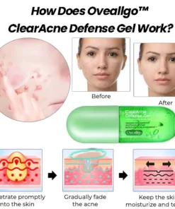 Experto en reparación de la piel con acné patentado exclusivo de ZitZap™: limpieza y acné