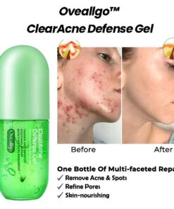 ZitZap™ Exclusive Patent Acne Skin Repair Expert-Cleansing and Acne