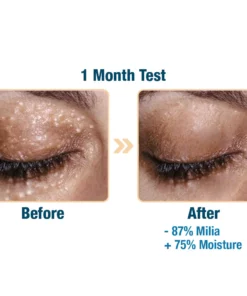 flysmus™ CaviarLuxe Far Infrared Radiance Milk Spot Cream