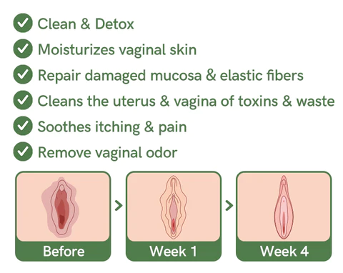 Furzero™ Natural Repair Vaginal Capsules