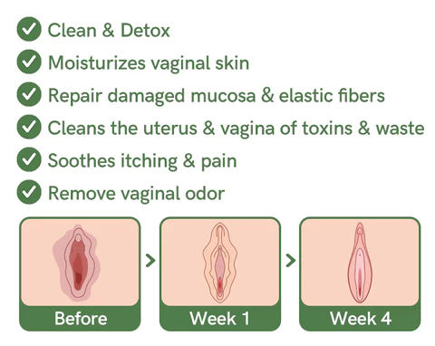 Furzero™ Natural Repair -emätinkapselit