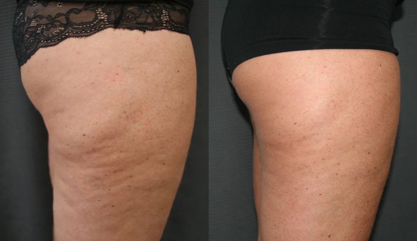 Ceoerty™ GlowBod Skin Firming Lotion 