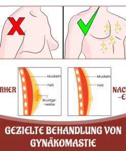 Biancat™ SleekChest Gynäkomastie Cellulite Schmelz-Pflaster