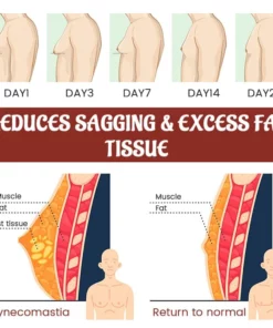 Biancat™ SleekChest Gynecomastia Cellulite Melting Patch