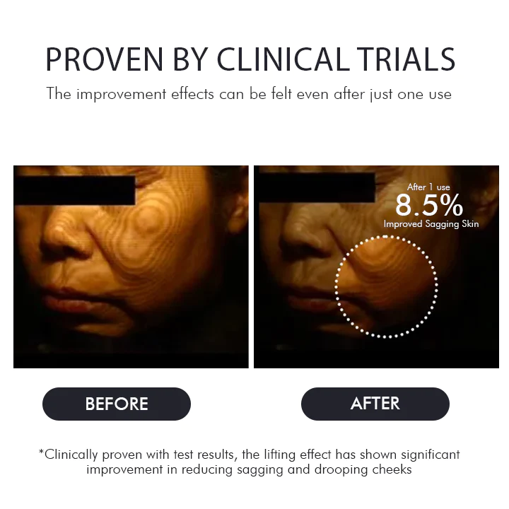 Oveallgo™ Korea Gold Seal Lifting Cream+ 2-in-1 Red Light / EMS teraapiaseadmete komplekt