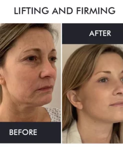 Oveallgo™ Korean Gold Seal Lifting Cream+ 2-in-1 Red Light / EMS Therapy Device SET