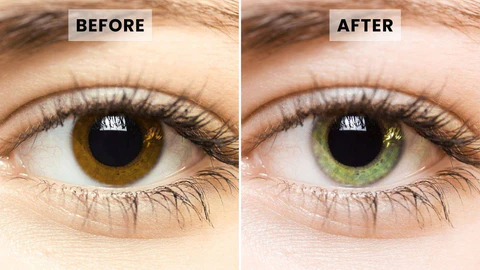 Collirio AAFQ® per il miglioramento e il cambiamento del colore degli occhi