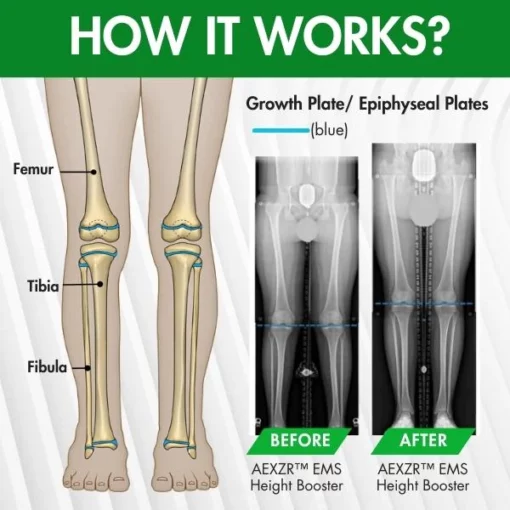 AEXZR ™ EMS Height Booster