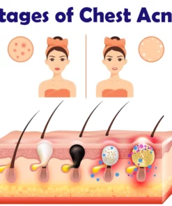 ATTDX BustLifter Whitening Tightening Cream