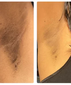 ATTDX Volcanic Mineral Absorbing Roller Stick