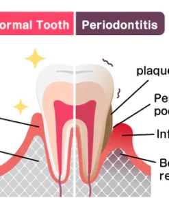 All Nature Oral Gum Therapy Treatment Gel