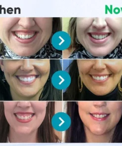 All Nature Oral Gum Therapy Treatment Gel