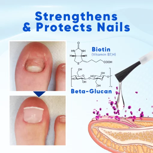 Biancat™ OnyxoGuard Nail Growth and Repair Serum