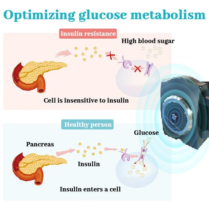 Biancat™ GylcoNova Electric Pulse Device