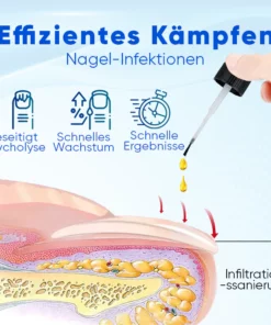 Biancat™ OnyxoGuard Nagelwachstums- und Reparaturs Serum