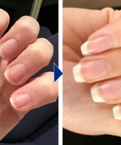 Biancat™ OnyxoGuard Nail Growth and Repair Serum