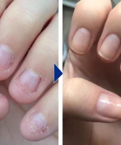 Biancat™ OnyxoGuard Nail Growth and Repair Serum