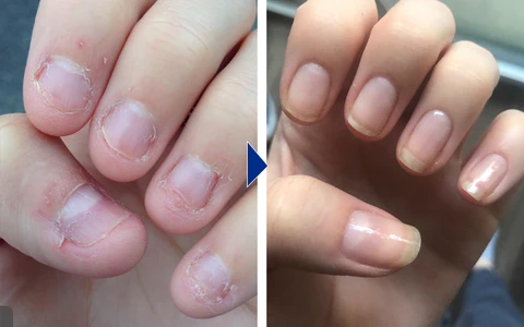 Biancat™ OnyxoGuard Nail Growth and Repair Serum