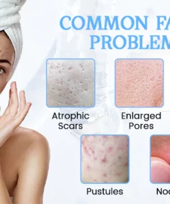 Oveallgo™ PoreClear 2% BHA Skin Renewal Liquid