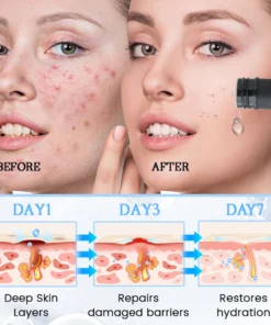 Oveallgo™ PoreClear 2% BHA Skin Renewal Liquid