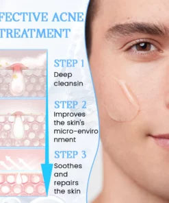 Biancat™ PoreClear 2% BHA Skin Renewal Liquid