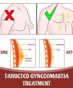 Biancat™ SleekChest Gynecomastia Cellulite Melting Patch