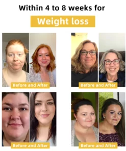 COLORIVER™ Bee Venom Shaping Bra