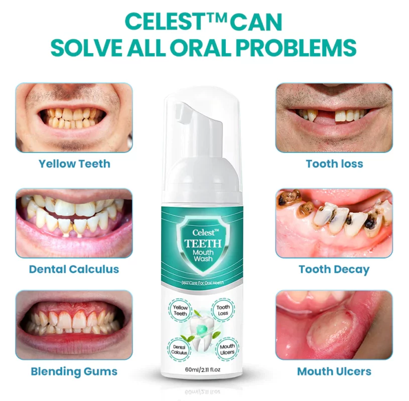 Celest™ TEETH Mouthwash - Solve all Oral Problems