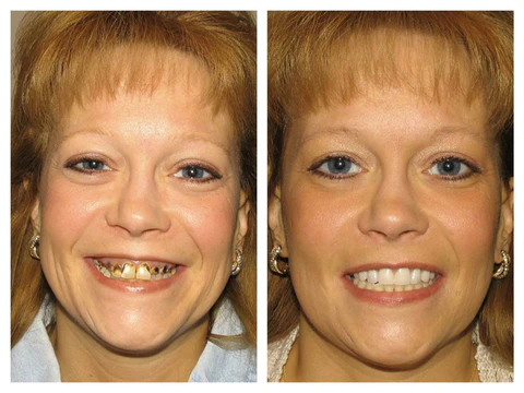 Celest™ TEETH Mouthwash - Solve all Oral Problems