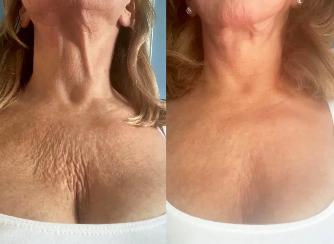 Ceoerty™ GlowBod Skin Firming Lotion 
