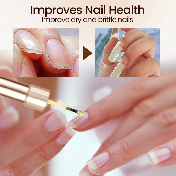 Ceoerty™ Vitamin E Nail Repair Serum