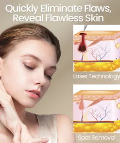 Ceoerty™ Flawless Spot Removal Pen