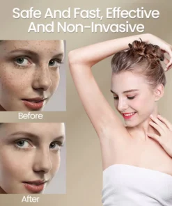 Ceoerty™ Flawless Spot Removal Pen