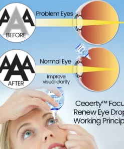 Ceoerty™ Focus Renew Eye Drops