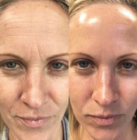 Ceoerty™ ReversiAge NMN Dual Repair Mask