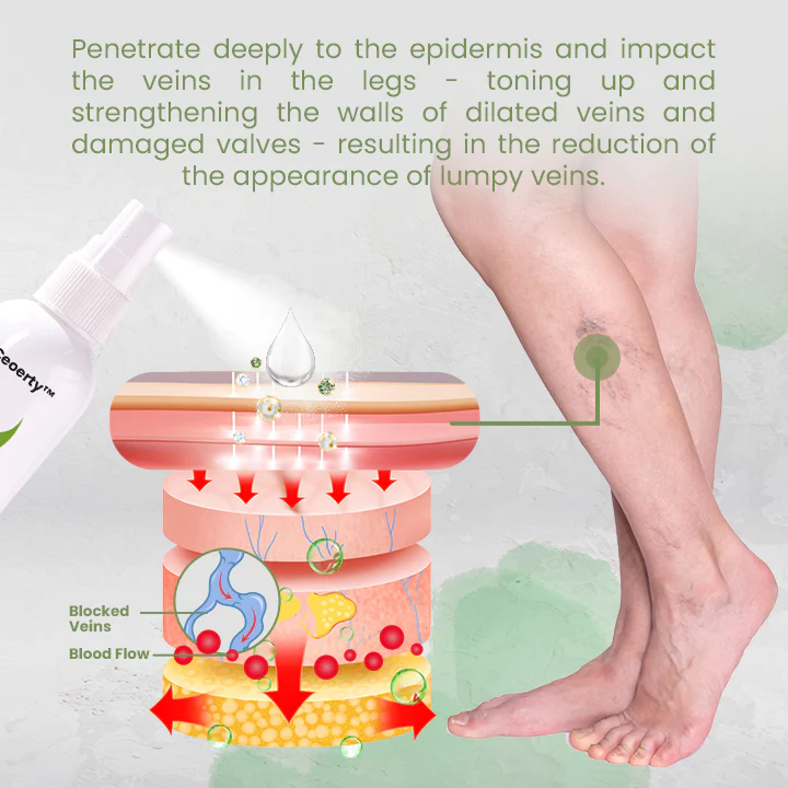 Ceoerty™ VeinCare Varicose Treatment Spray