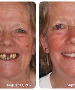 Cocomint™ Oral Health Pulling Oil - Solve all Oral Problems