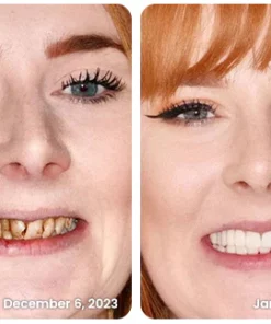 Cocomint™ Oral Health Pulling Oil - Solve all Oral Problems