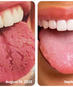 Cocomint™ Oral Health Pulling Oil - Solve all Oral Problems