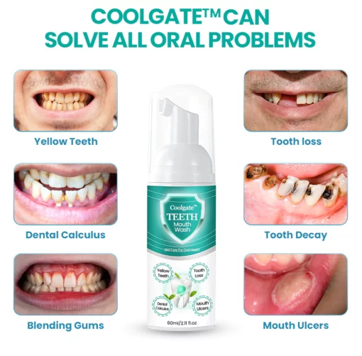 Coolgate™ TEETH Mouthwash Foam - Solve All Oral Problems