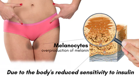 Coolord™ Feminine Brightening Pinkish Essence