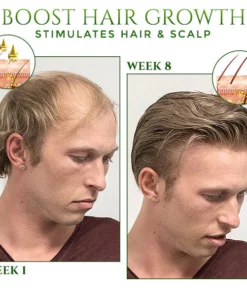 CrownCure™ Red Ginseng Hair Growth Serum