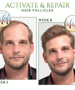 CrownCure™ Red Ginseng Hair Growth Serum