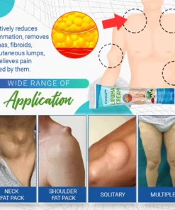 Cvreoz Bee Venom Lipomas Elimination Treatment Spray